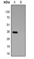 GST-tag Rabbit Polyclonal Antibody