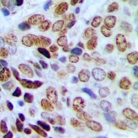 HP1 gamma (Phospho-S93) Rabbit Polyclonal Antibody