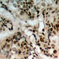 PTEN (Phospho-S380/T382/T383) Rabbit Polyclonal Antibody
