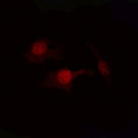 PTEN (Phospho-S380/T382/T383) Rabbit Polyclonal Antibody