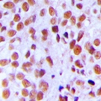 Ku80 (Phospho-T714) Rabbit Polyclonal Antibody