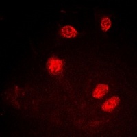 Ku80 (Phospho-T714) Rabbit Polyclonal Antibody