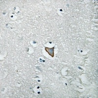 HER3 (Phospho-Y1222) Rabbit Polyclonal Antibody