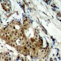 CDK11B Rabbit Polyclonal Antibody