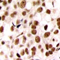 C/EBP zeta Antibody