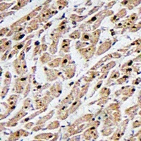 MAPKAPK3 Antibody