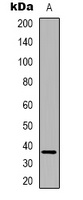 FAM84B Rabbit Polyclonal Antibody