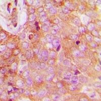 FAM84B Rabbit Polyclonal Antibody