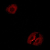Collagen 19 alpha 1 Antibody