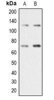 RAD21 Rabbit Polyclonal Antibody
