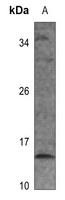RPS12 Rabbit Polyclonal Antibody