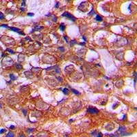 RPS12 Rabbit Polyclonal Antibody