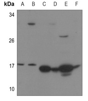 RPS13 Rabbit Polyclonal Antibody