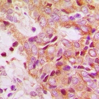 RPS13 Rabbit Polyclonal Antibody