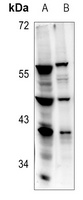 RPL5 Rabbit Polyclonal Antibody
