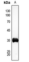 AKR1C2 Rabbit Polyclonal Antibody