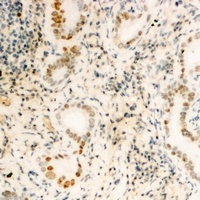 FUBP3 Rabbit Polyclonal Antibody