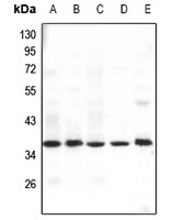 GHITM Rabbit Polyclonal Antibody