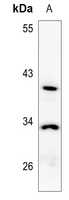 NXPH3 Rabbit Polyclonal Antibody