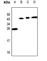 PP15 Rabbit Polyclonal Antibody