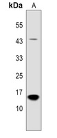 PP15 Rabbit Polyclonal Antibody