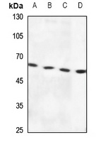 RSAD1 Rabbit Polyclonal Antibody