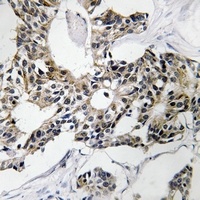 RSAD1 Rabbit Polyclonal Antibody