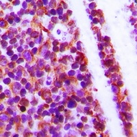 WIPF1 Rabbit Polyclonal Antibody