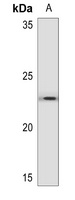 BNIP3 Rabbit Polyclonal Antibody