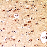 BNIP3 Rabbit Polyclonal Antibody