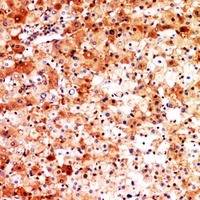 CD276 Rabbit Polyclonal Antibody