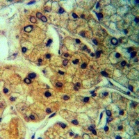 GPCR135 Rabbit Polyclonal Antibody