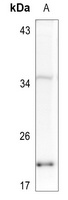 Histone H2A.X (Phospho-S139) Rabbit Polyclonal Antibody