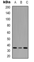 ATF1 (Phospho-S63) Rabbit Polyclonal Antibody