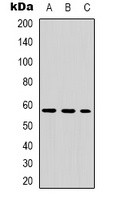Tyrosine Hydroxylase (Phospho-S8) Rabbit Polyclonal Antibody
