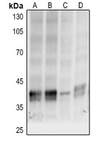 p38 (Phospho-T180/Y182) Antibody