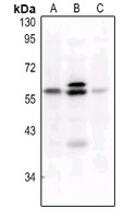 c-FOS (Phospho-S32) Rabbit Polyclonal Antibody
