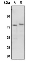 p47 phox (Phospho-S345) Rabbit Polyclonal Antibody