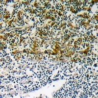 p47 phox (Phospho-S345) Rabbit Polyclonal Antibody