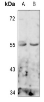 PTEN Rabbit Polyclonal Antibody