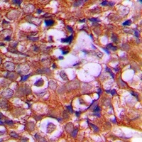 PTEN Rabbit Polyclonal Antibody