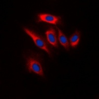 PTEN Rabbit Polyclonal Antibody