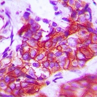 TRK A Rabbit Polyclonal Antibody