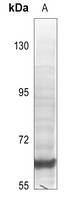SPHK2 Rabbit Polyclonal Antibody