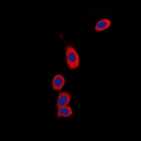 RPS6KC1 Antibody
