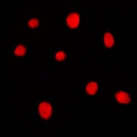 MRG15 Rabbit Polyclonal Antibody