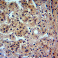 CADM1 Rabbit Polyclonal Antibody