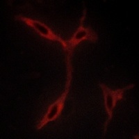 CADM1 Rabbit Polyclonal Antibody