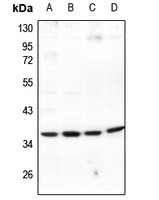 EIF3J Rabbit Polyclonal Antibody