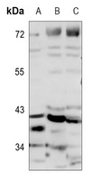 MRPS22 Rabbit Polyclonal Antibody